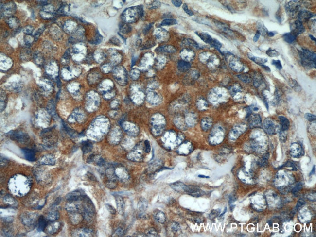 CHOP Antibody in Immunohistochemistry (Paraffin) (IHC (P))