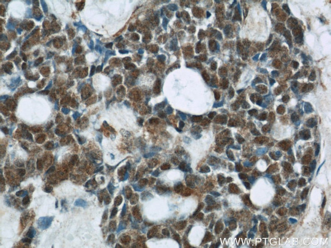 CHOP Antibody in Immunohistochemistry (Paraffin) (IHC (P))