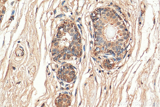 CHOP Antibody in Immunohistochemistry (Paraffin) (IHC (P))