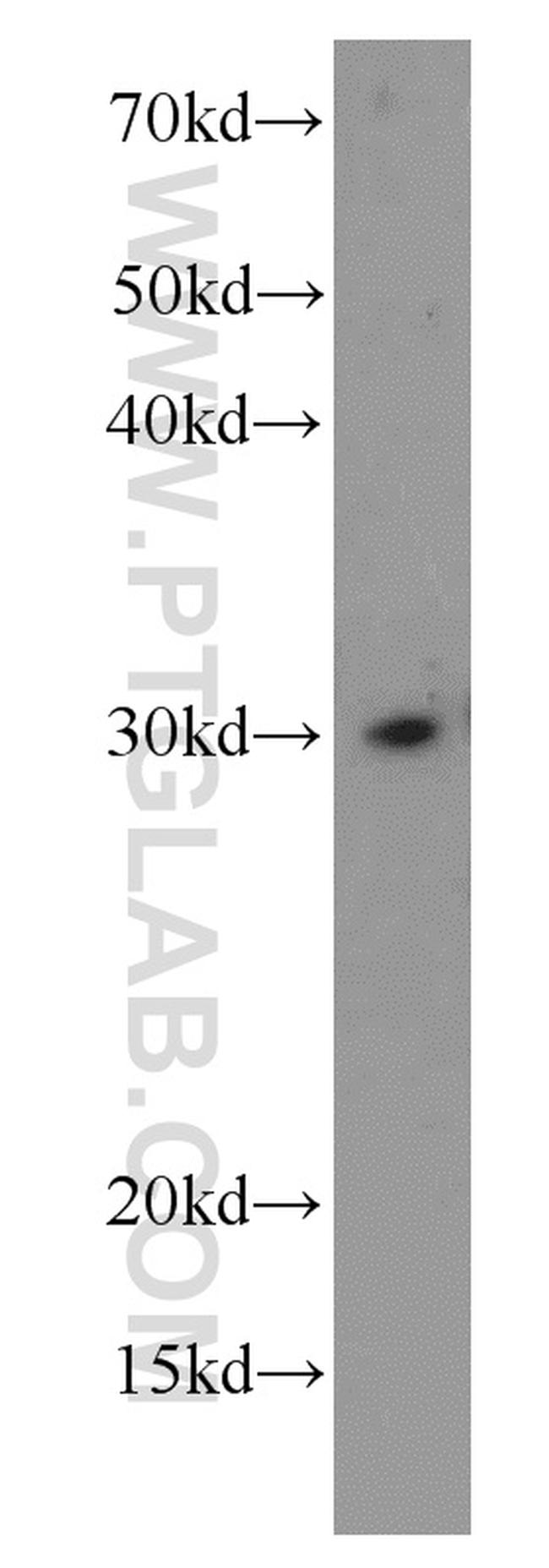 CHOP Antibody in Western Blot (WB)