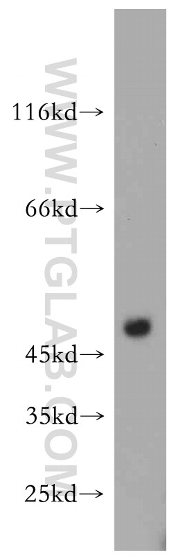 FADS3 Antibody in Western Blot (WB)