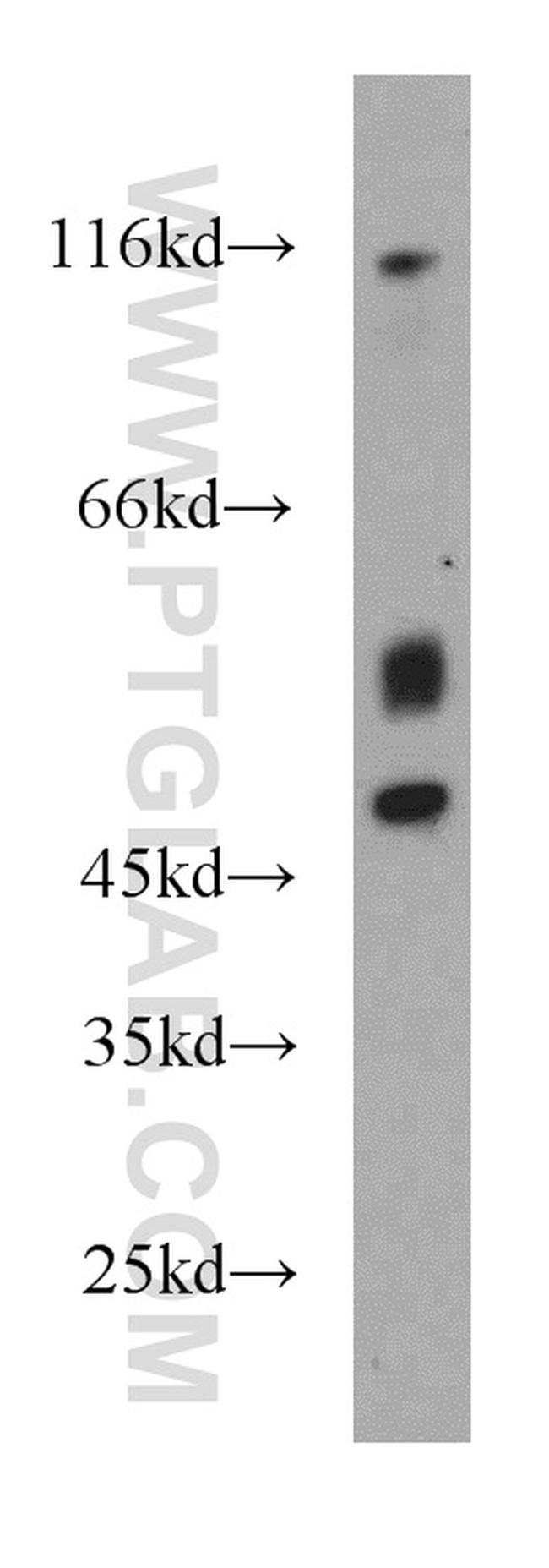 FADS3 Antibody in Western Blot (WB)