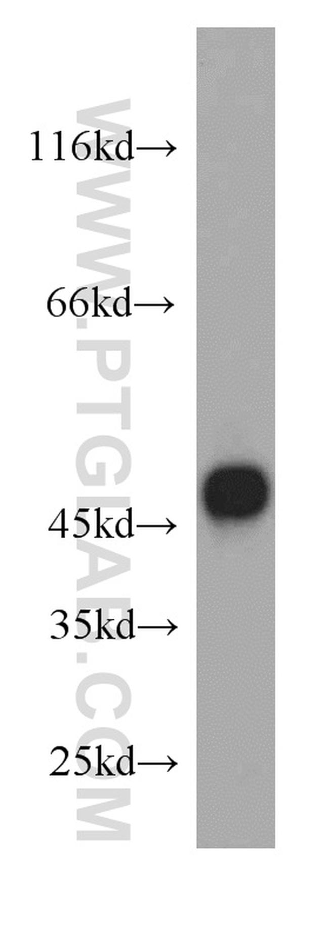 FADS3 Antibody in Western Blot (WB)