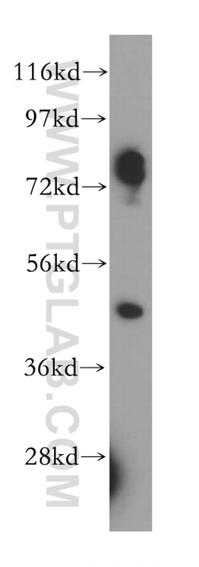 CRACR2A Antibody in Western Blot (WB)