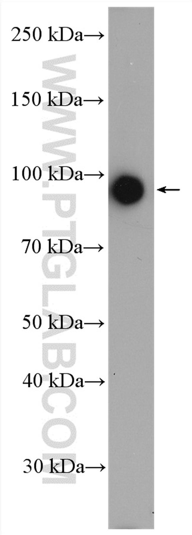 CRACR2A Antibody in Western Blot (WB)