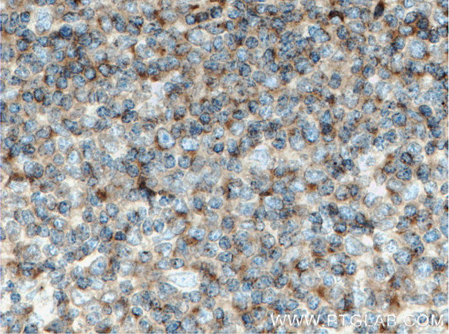 CRACR2A Antibody in Immunohistochemistry (Paraffin) (IHC (P))