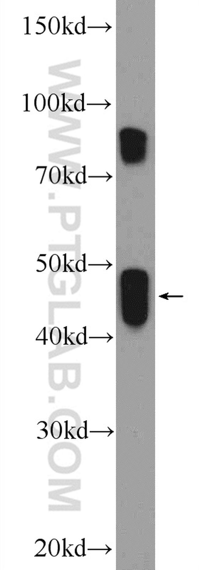 CRACR2A Antibody in Western Blot (WB)