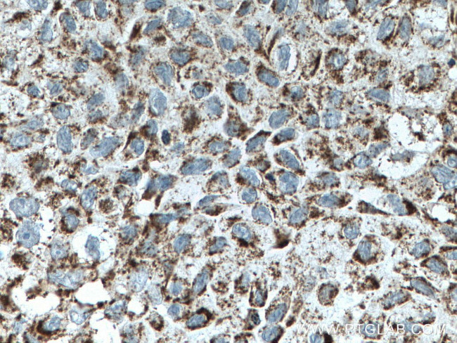 OGDH Antibody in Immunohistochemistry (Paraffin) (IHC (P))