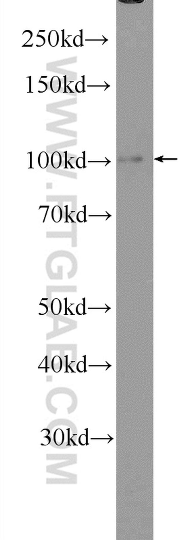 OGDH Antibody in Western Blot (WB)