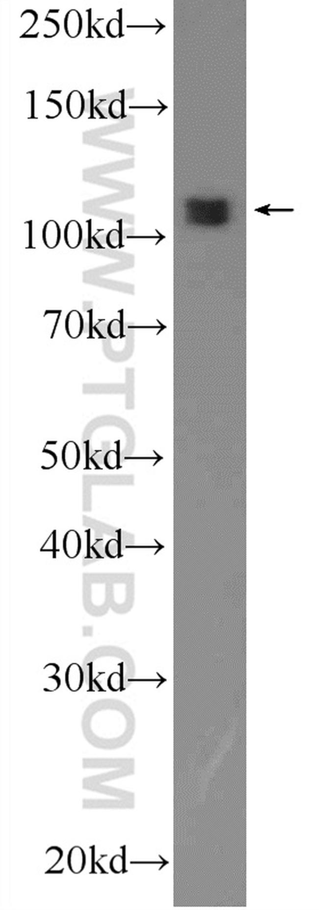 OGDH Antibody in Western Blot (WB)