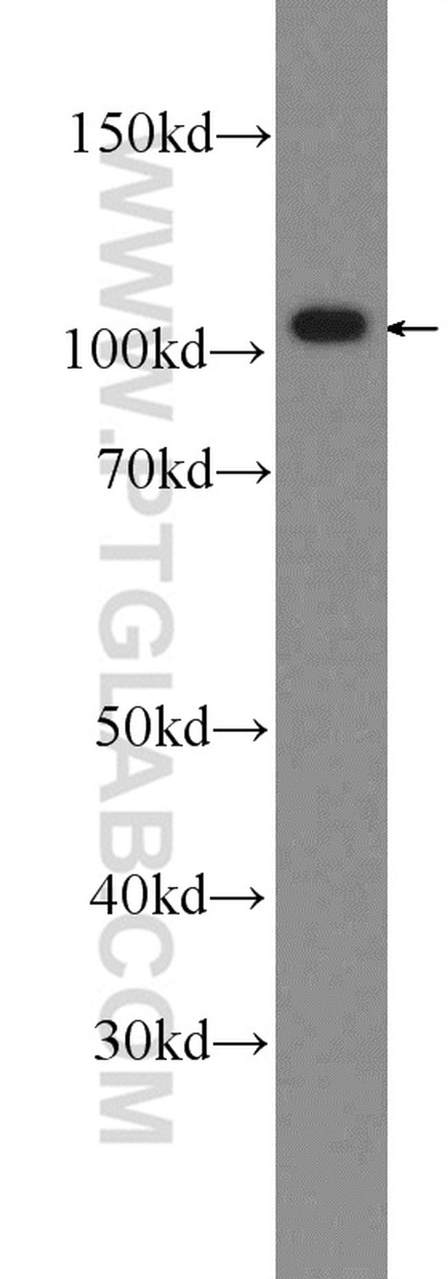 OGDH Antibody in Western Blot (WB)