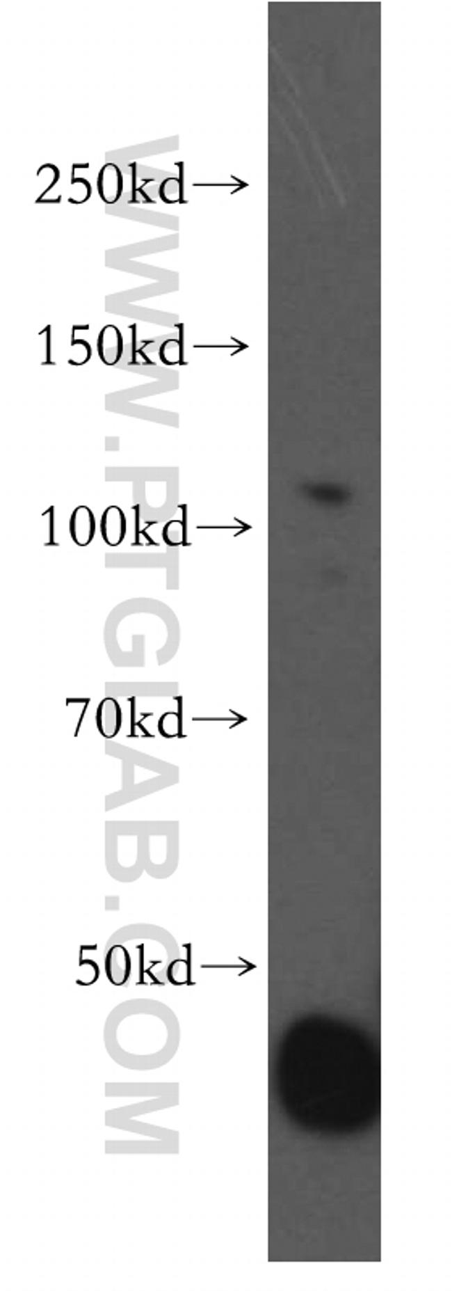 OGDH Antibody in Western Blot (WB)