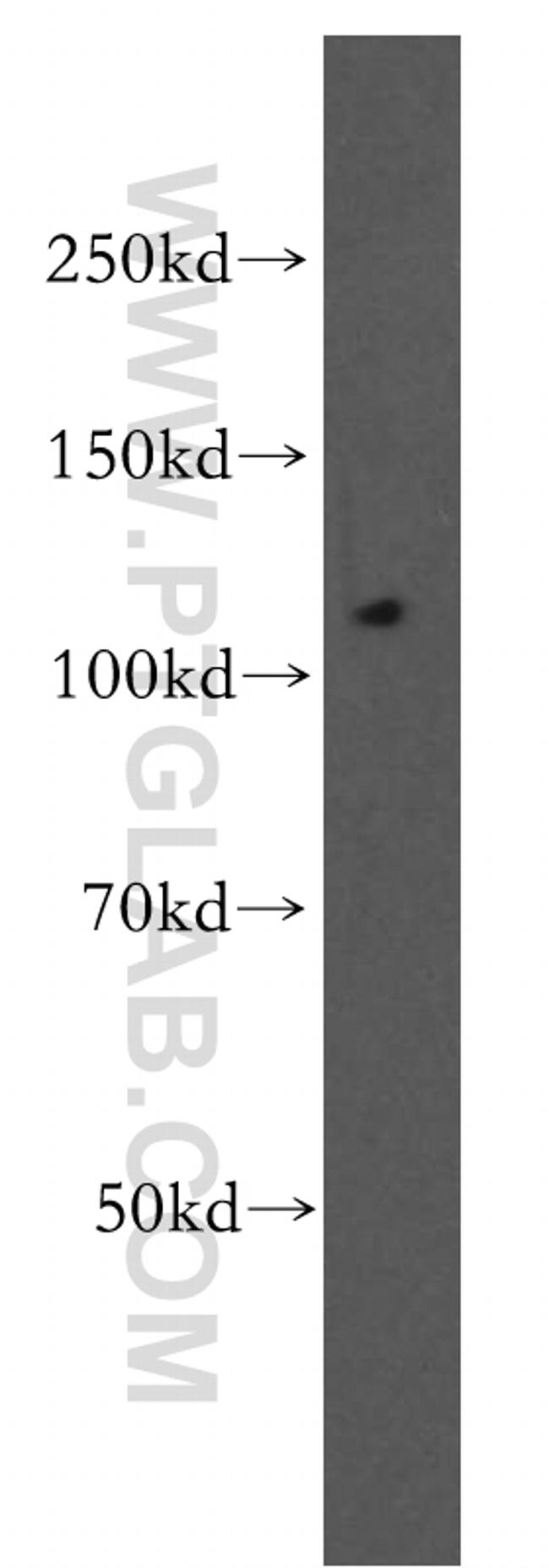 OGDH Antibody in Western Blot (WB)