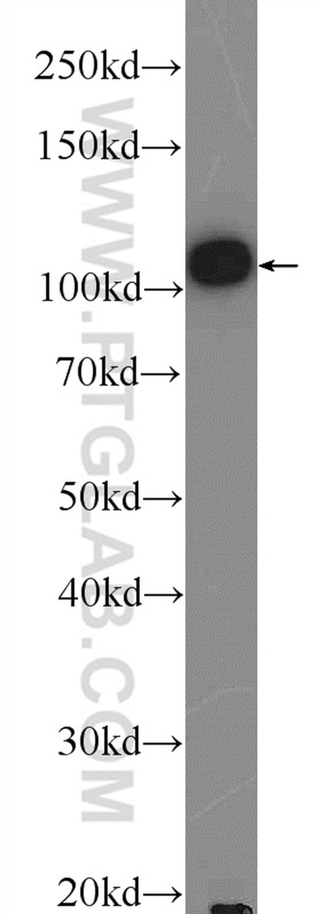 OGDH Antibody in Western Blot (WB)