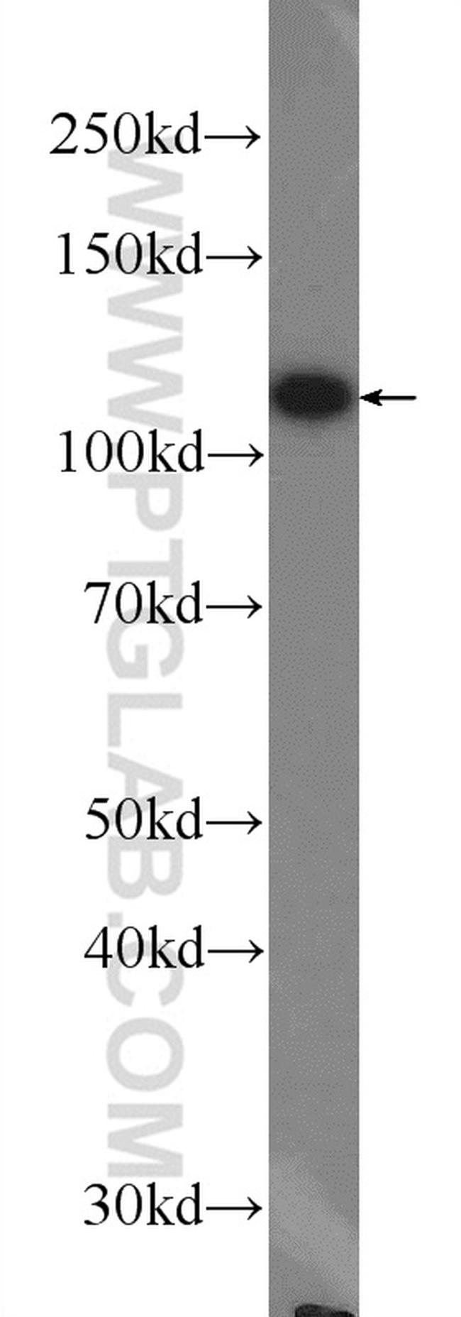 OGDH Antibody in Western Blot (WB)