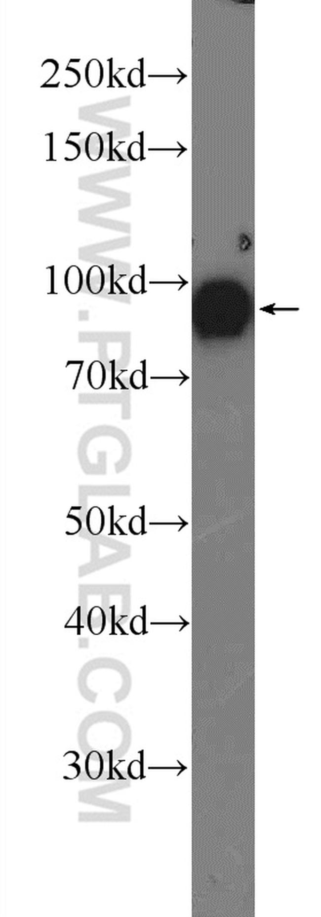 OGDH Antibody in Western Blot (WB)