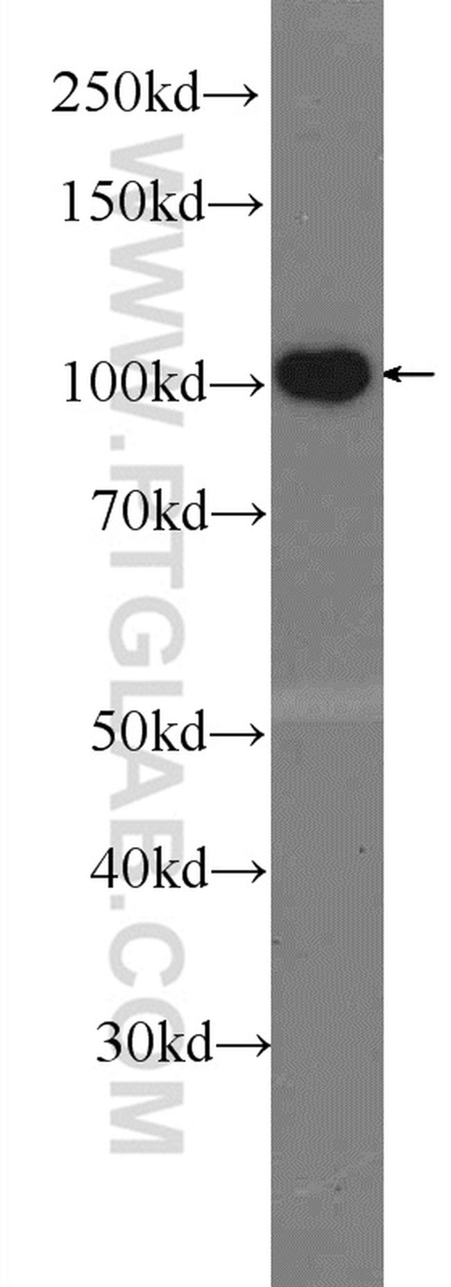 OGDH Antibody in Western Blot (WB)