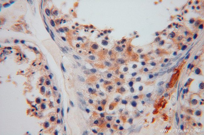 GSTM3 Antibody in Immunohistochemistry (Paraffin) (IHC (P))