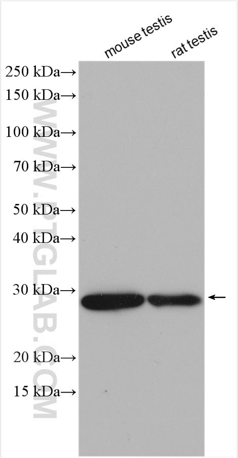 GSTM3 Antibody in Western Blot (WB)