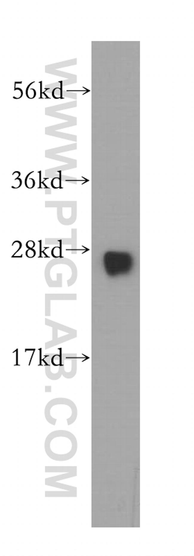 GSTM3 Antibody in Western Blot (WB)