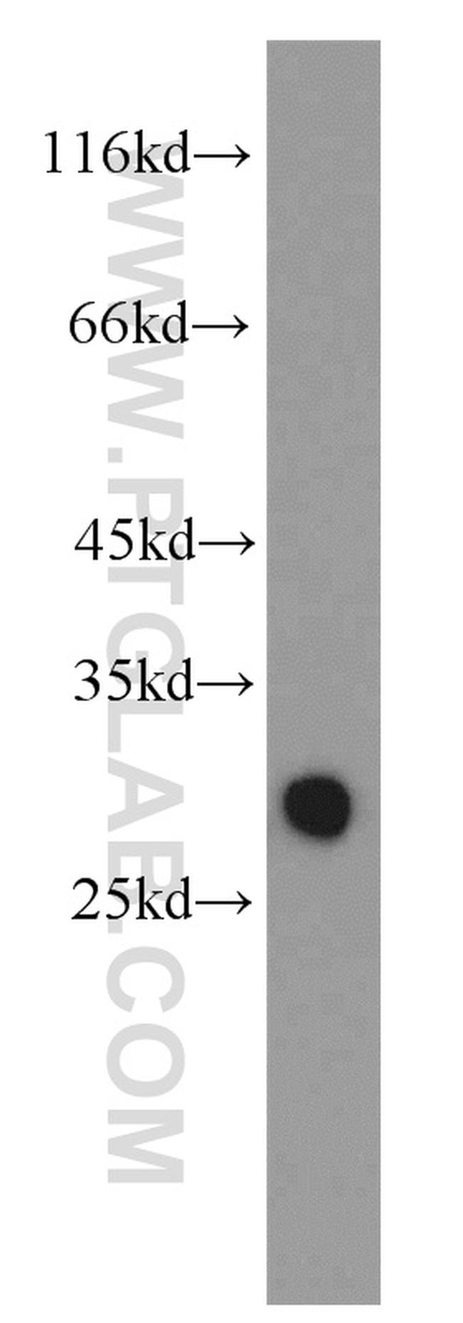 GSTM3 Antibody in Western Blot (WB)