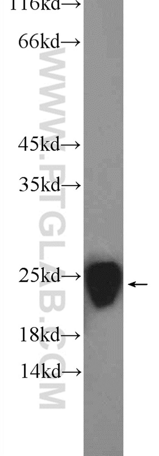 PTGES3 Antibody in Western Blot (WB)