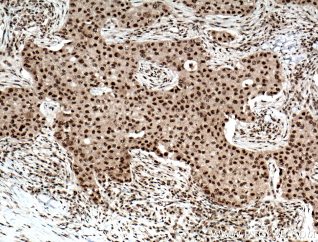 RPB5 Antibody in Immunohistochemistry (Paraffin) (IHC (P))