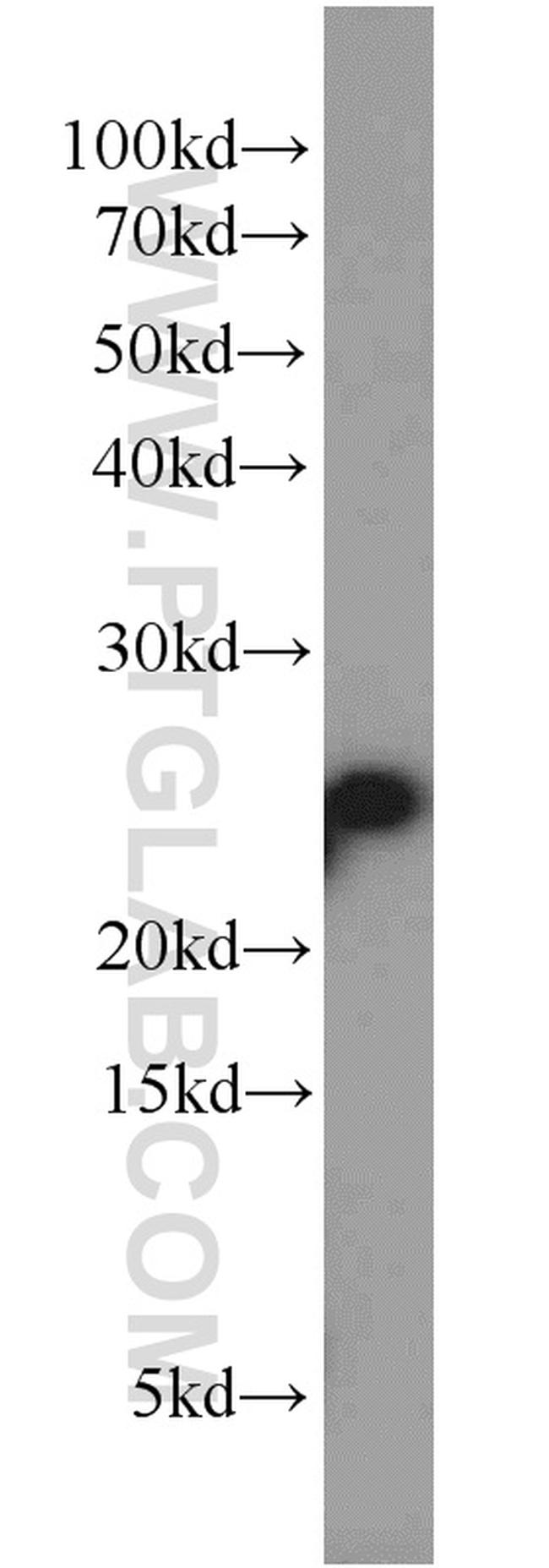 RPB5 Antibody in Western Blot (WB)