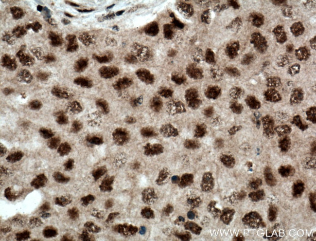 RPB5 Antibody in Immunohistochemistry (Paraffin) (IHC (P))