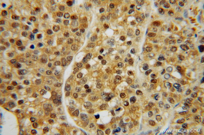 PSMA7 Antibody in Immunohistochemistry (Paraffin) (IHC (P))