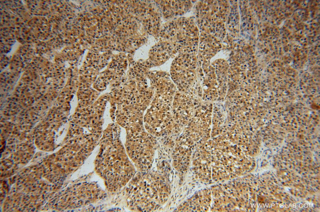 PSMA7 Antibody in Immunohistochemistry (Paraffin) (IHC (P))