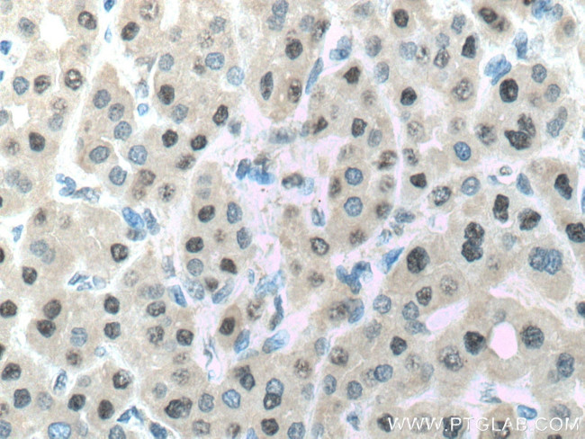 PSMA7 Antibody in Immunohistochemistry (Paraffin) (IHC (P))