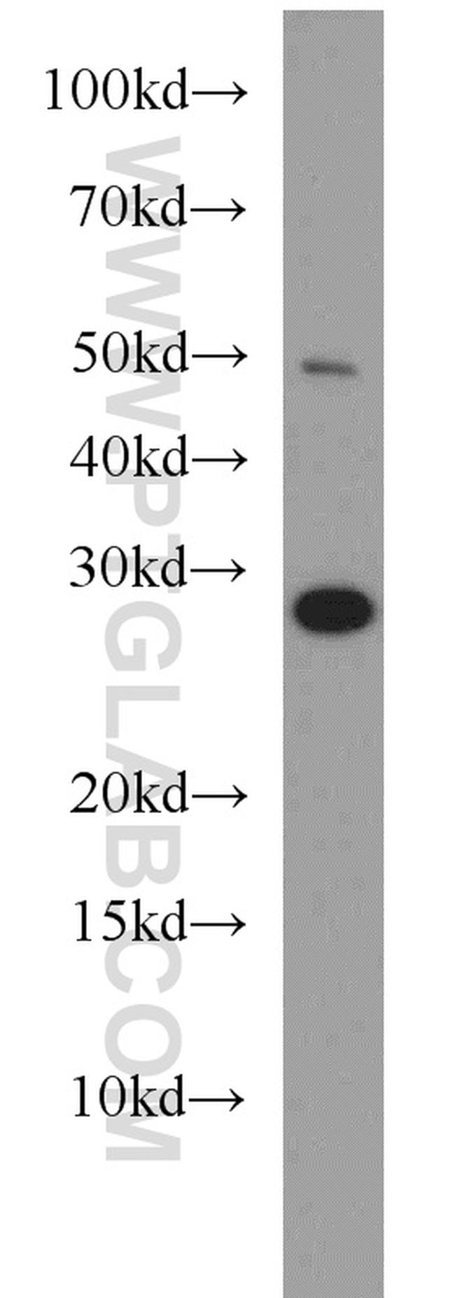 PSMA7 Antibody in Western Blot (WB)