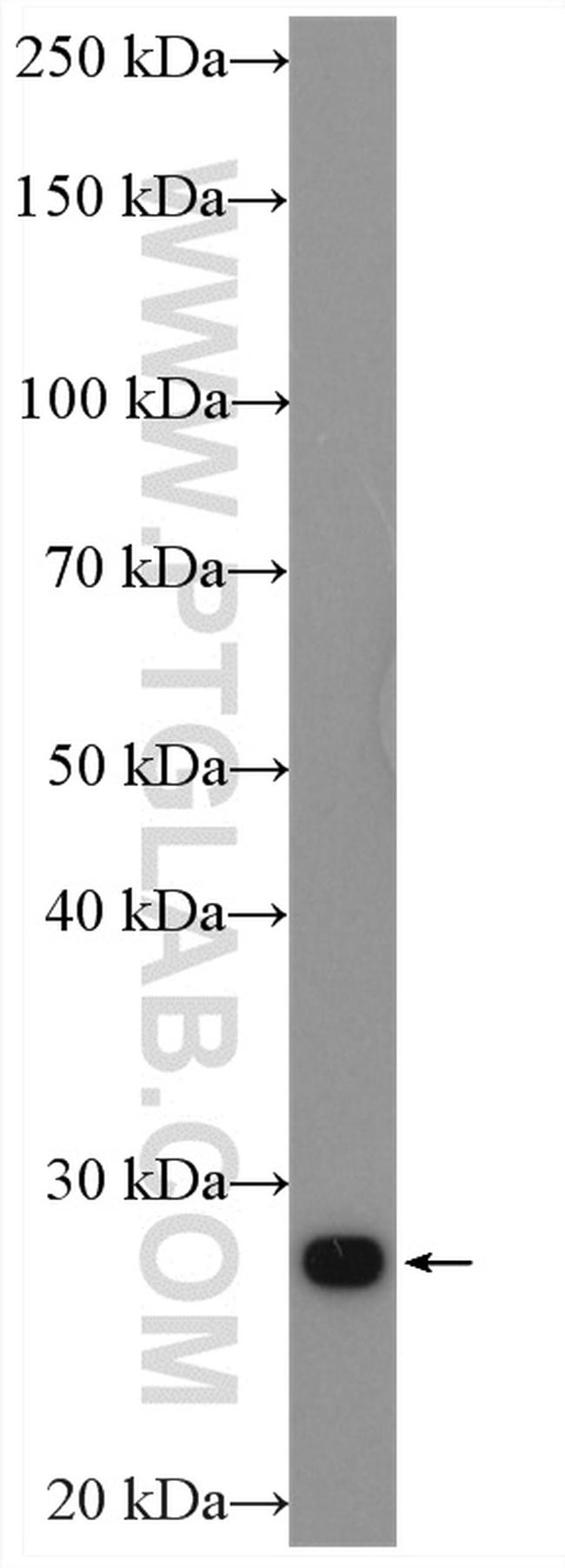 PSMA7 Antibody in Western Blot (WB)