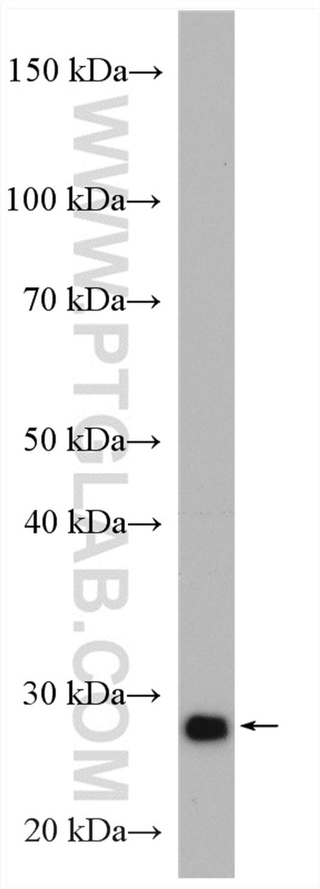 PSMA7 Antibody in Western Blot (WB)