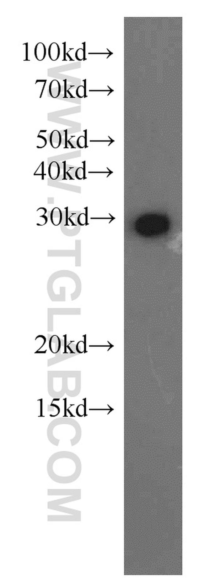 PSMA7 Antibody in Western Blot (WB)