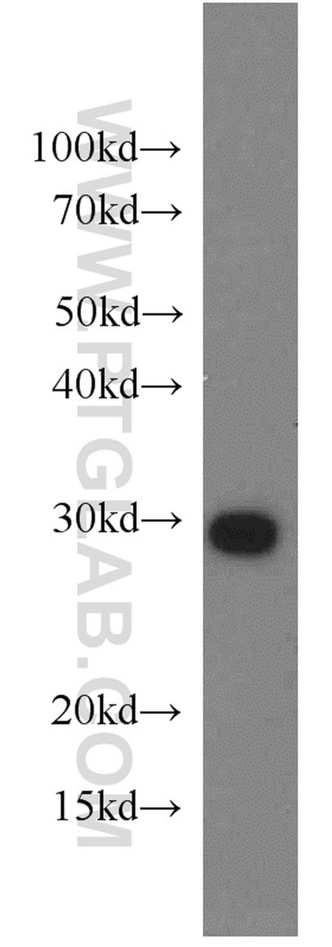 PSMA7 Antibody in Western Blot (WB)