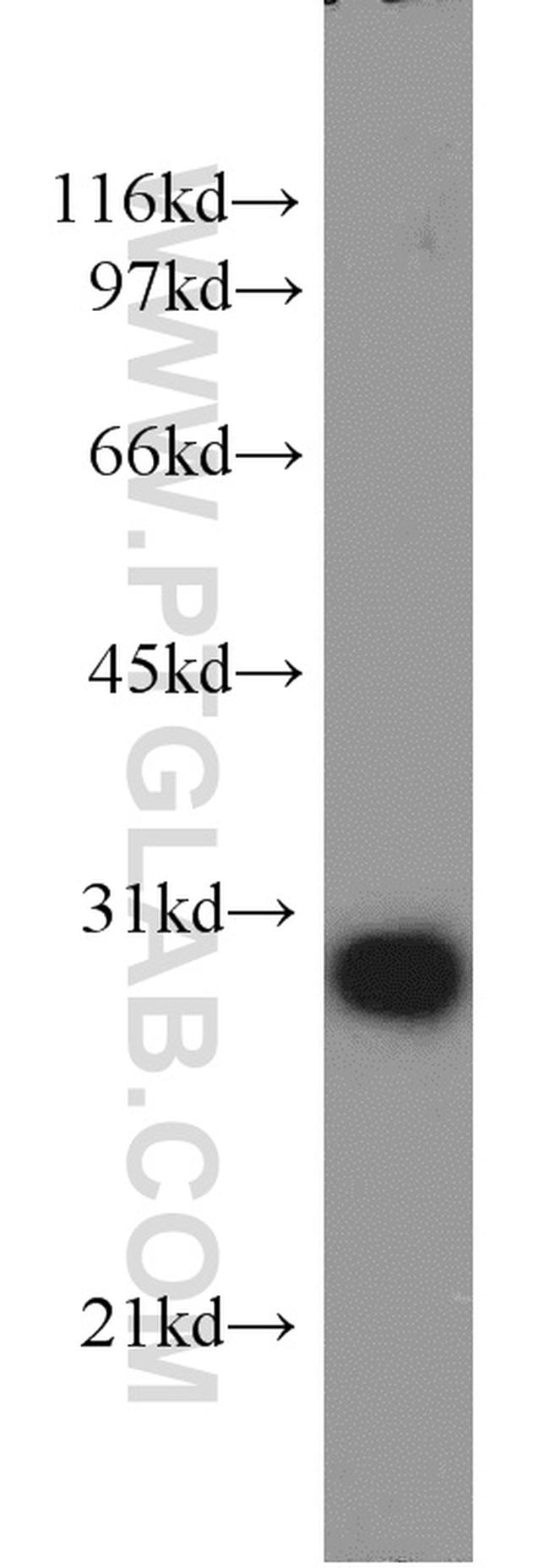 PSMA7 Antibody in Western Blot (WB)