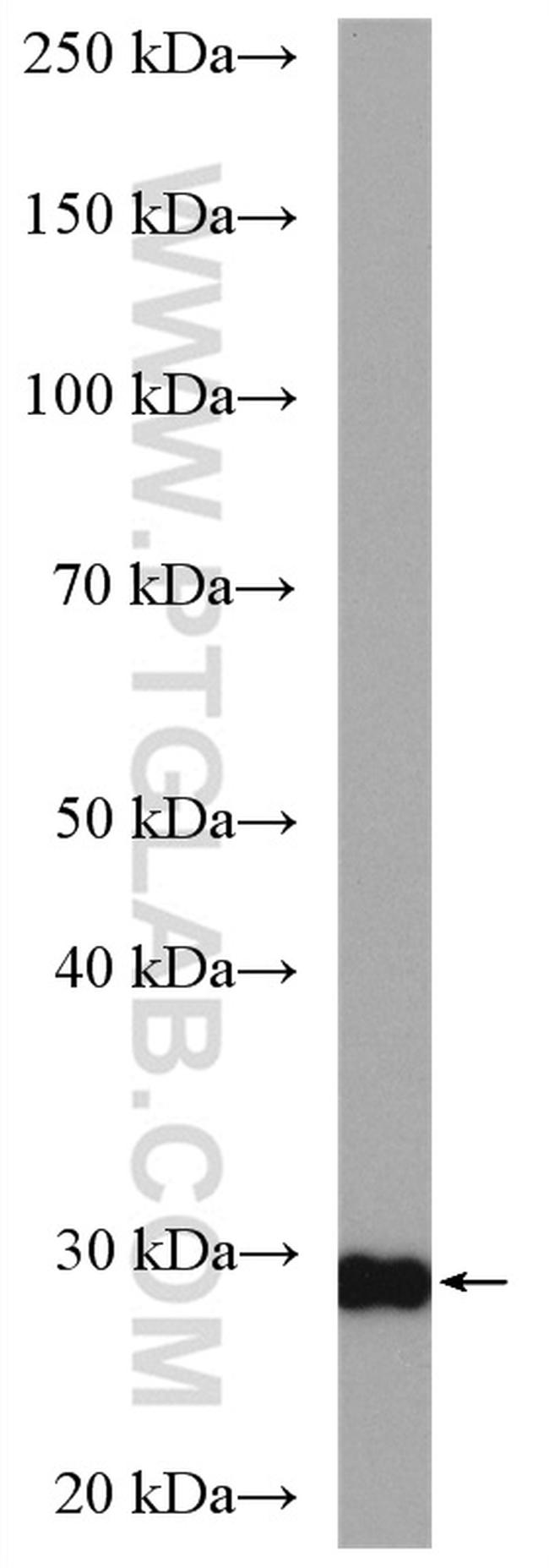 PSMA7 Antibody in Western Blot (WB)