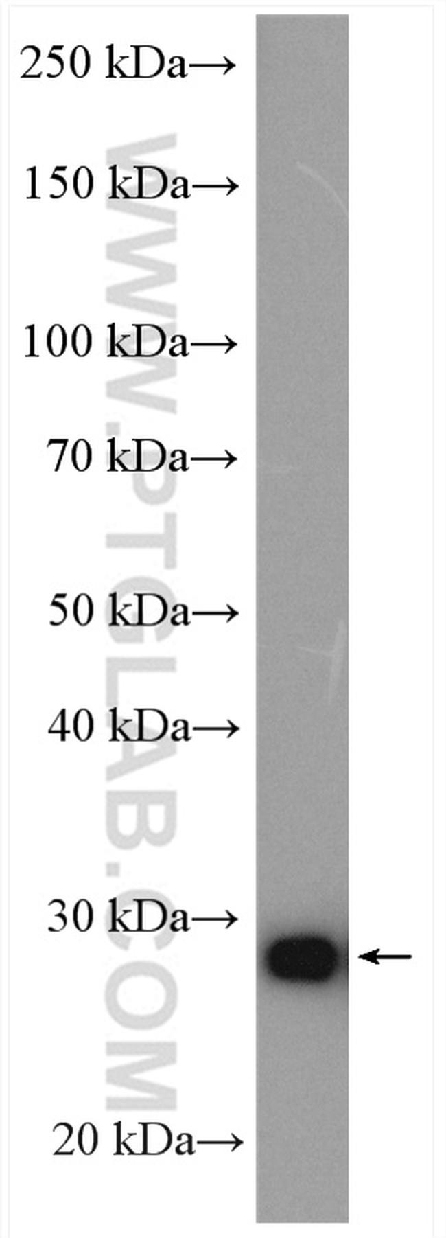 PSMA7 Antibody in Western Blot (WB)