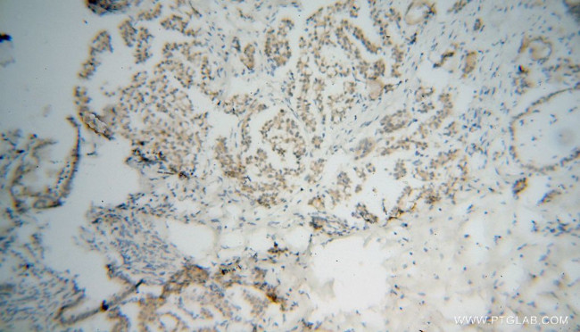 RPAIN Antibody in Immunohistochemistry (Paraffin) (IHC (P))