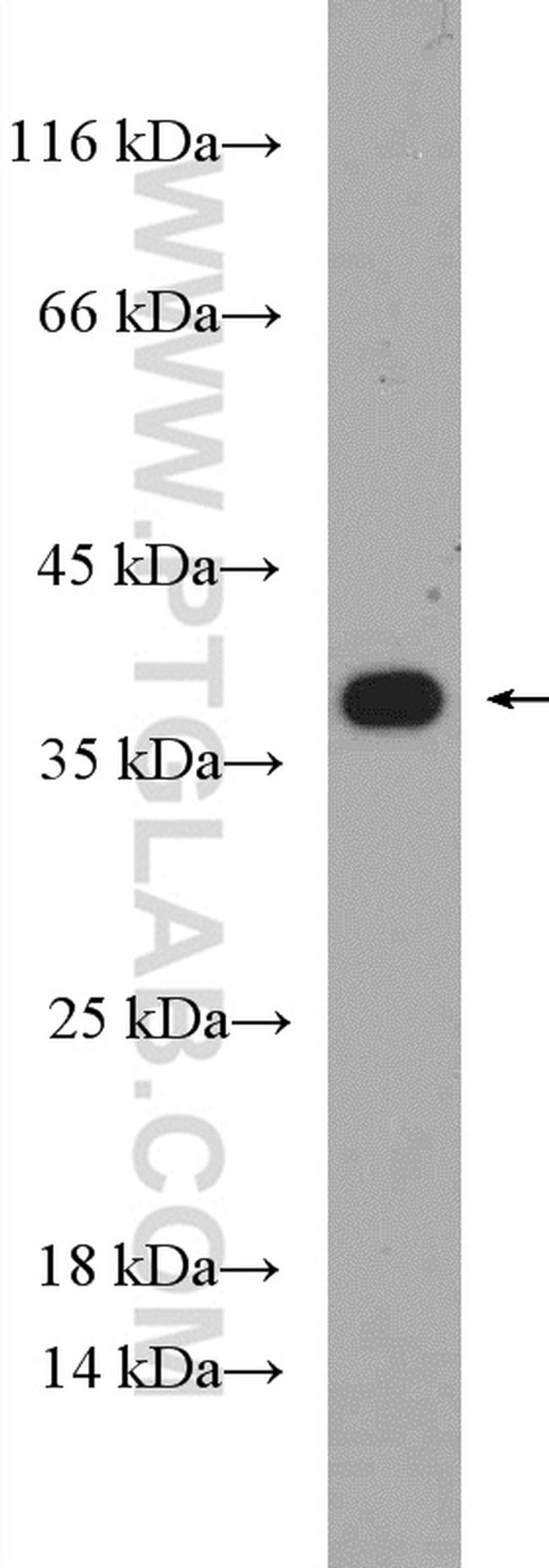 RPAIN Antibody in Western Blot (WB)