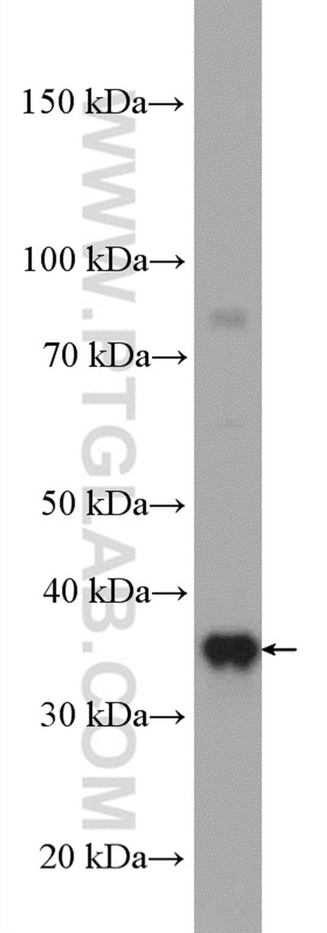 RPAIN Antibody in Western Blot (WB)