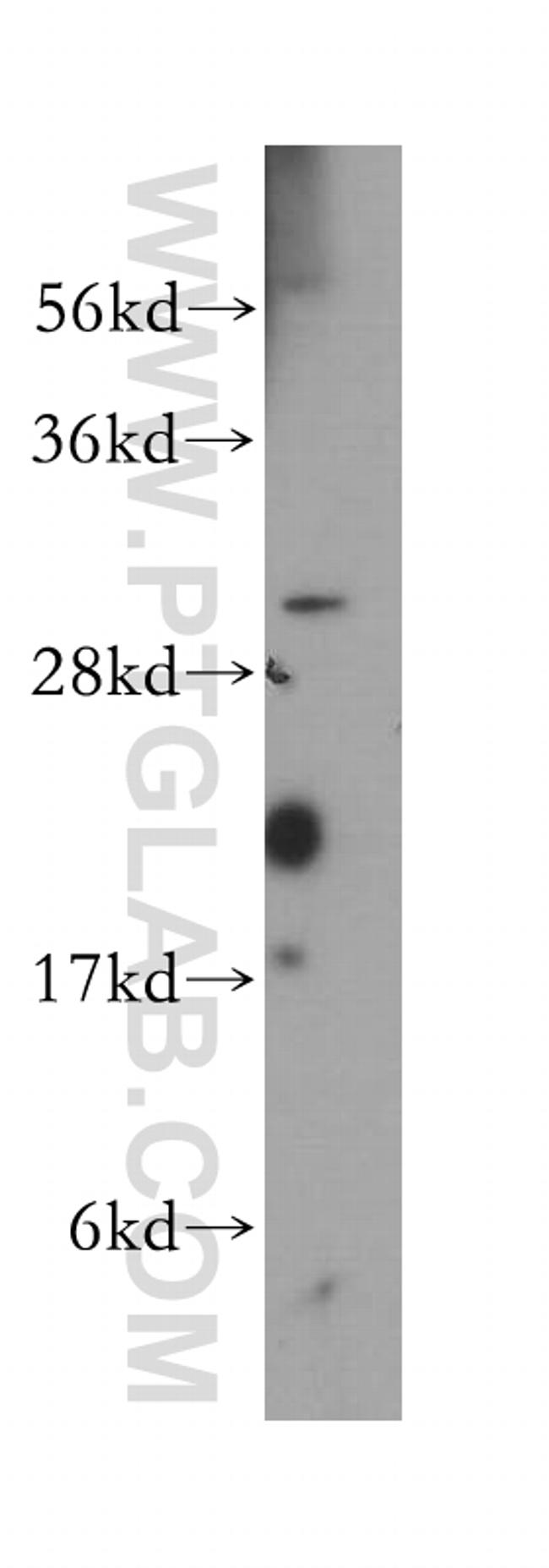 RPAIN Antibody in Western Blot (WB)