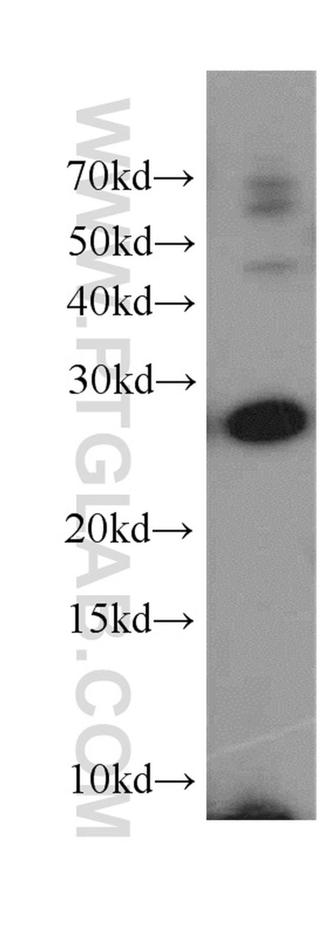 YWHAH Antibody in Western Blot (WB)