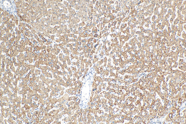 NDUFS5 Antibody in Immunohistochemistry (Paraffin) (IHC (P))