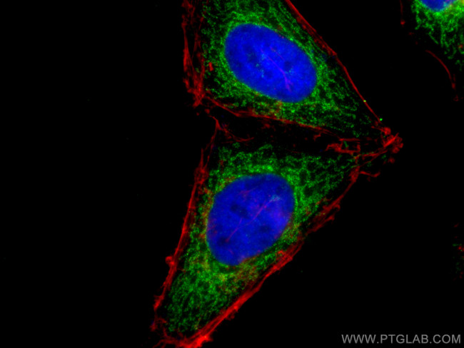 SLC25A1 Antibody in Immunocytochemistry (ICC/IF)