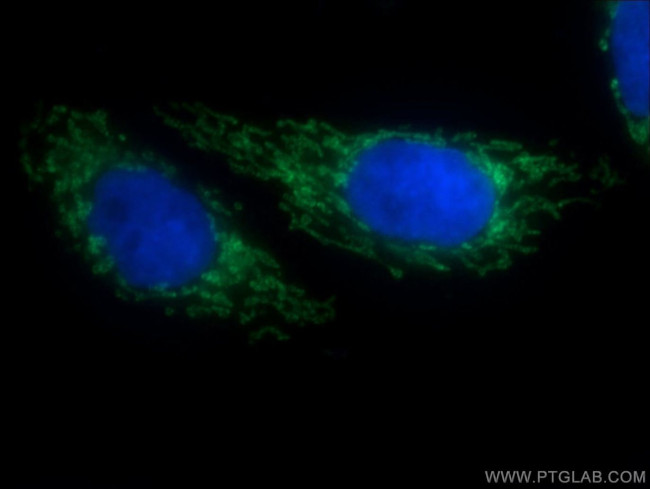 SLC25A1 Antibody in Immunocytochemistry (ICC/IF)