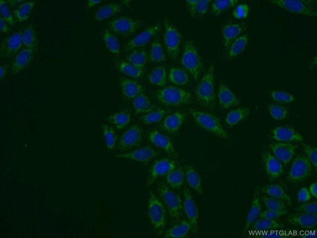 SLC25A1 Antibody in Immunocytochemistry (ICC/IF)