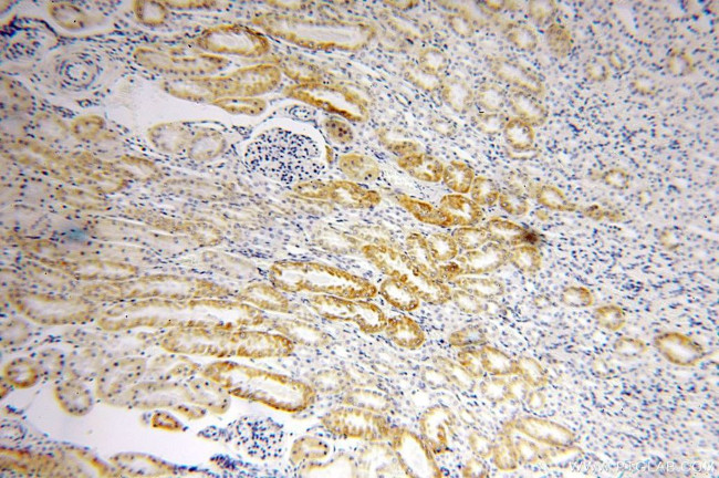 SLC25A1 Antibody in Immunohistochemistry (Paraffin) (IHC (P))